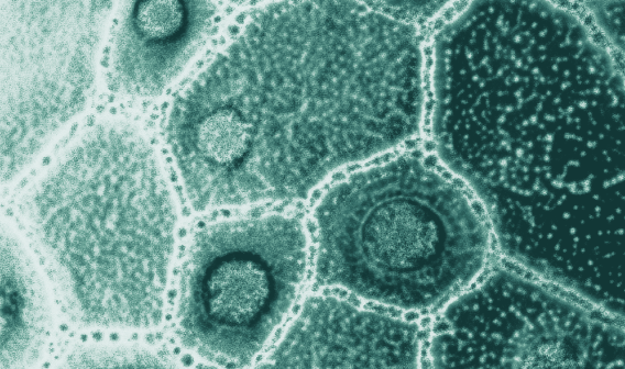 Prébiotiques, probiotiques et postbiotiques : différences, bienfaits et sources naturelles
